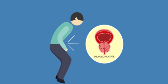 Banyak Pria Enggan Periksakan Kanker Prostat padahal Sudah Muncul Tanda-Tanda