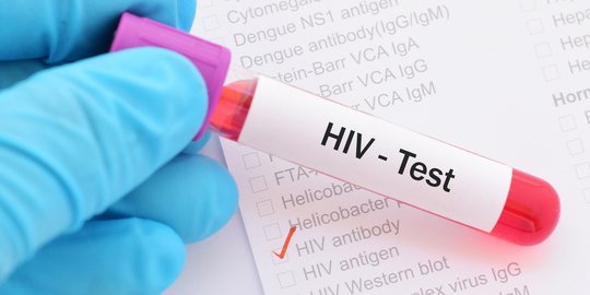 Tak Perlu Takut Ini Alasan Wajib Tes Hiv Sekarang Juga Merdeka 