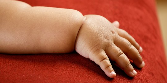Alami Bocor Jantung, Bayi di NTB Butuh Bantuan Untuk Pengobatan