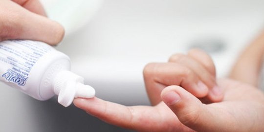 atau pasta gigi pada bekas luka bakar rev3