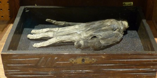 Hand of Glory, Sepotong Tangan Keramat Koleksi Museum di Inggris