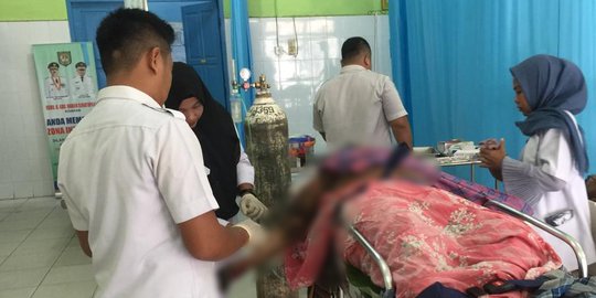 Nenek di Asahan yang Dibakar Anak Tiri Akhirnya Meninggal Dunia