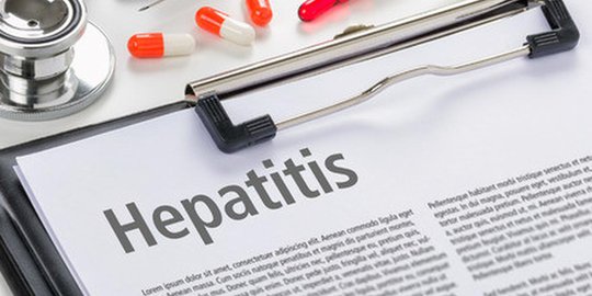 Pasien Hepatitis A Sebenarnya Tak Perlu Masuk Rumah Sakit Kecuali Ada Kondisi Khusus