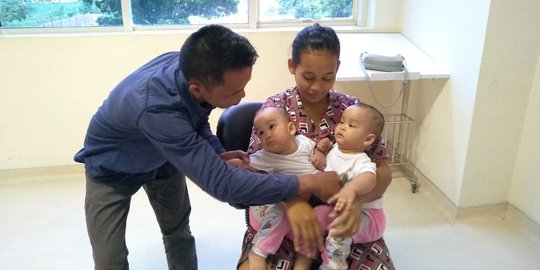 Tim Dokter Siapkan Operasi Pemisahan Bayi Kembar Siam Adam dan Malik