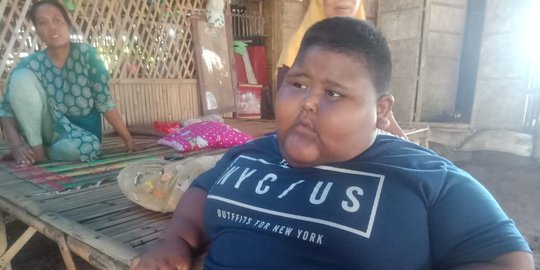 4 Kasus Obesitas Terjadi di Karawang, 2 Penderita Meninggal Dunia