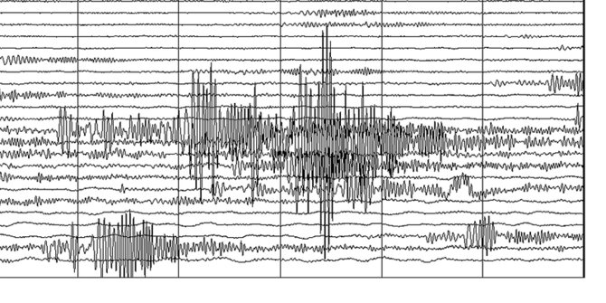 Gempa Magnitudo 7 dan Potensi Tsunami, Warga Manado ...