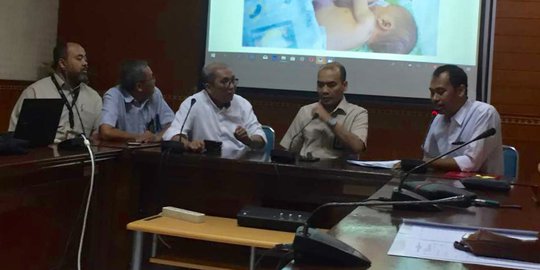 Rumah Sakit Tanggung Biaya Operasi Pemisahan Bayi Kembar Siam Adam-Malik