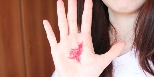 7 masalah kesehatan yang bisa dipicu akibat batuk