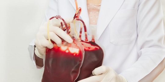 kelebihan zat besi dari tubuh rev1