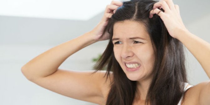 4 Cara Cegah Munculnya Keringat Berlebih pada Kulit Kepala