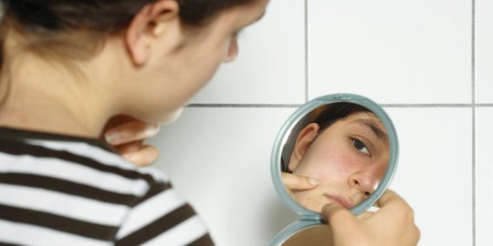 6 fakta seputar jerawat yang penting untuk kamu ketahui