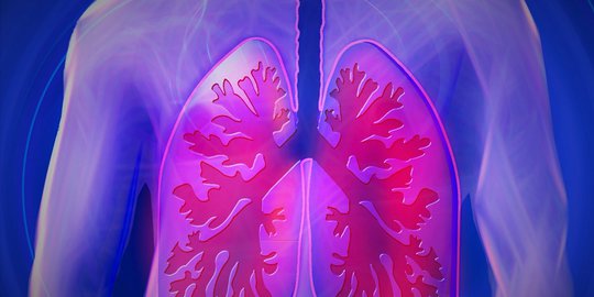 Kenali Gejala, Penyebab, dan Sejumlah Hal Lain Mengenai Pneumonia