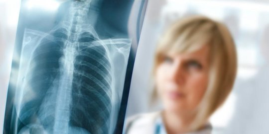 pneumonia rev2