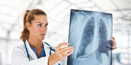 Pneumonia Pneumonia