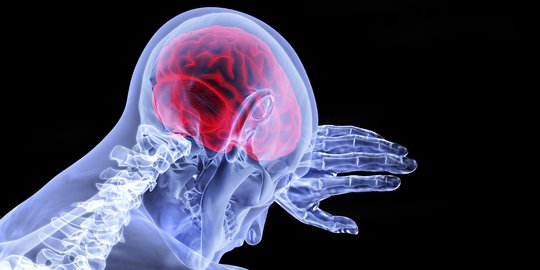 Kenali Sejumlah Faktor yang Mempengaruhi Terjadinya Aneurisma Otak