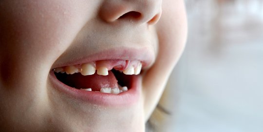 Masalah Gigi yang Dimiliki Seseorang Bisa Jadi Tanda Risiko Masalah Kardiovaskular