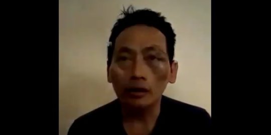 Polisi Amankan 8 Orang Diduga Penganiaya Ninoy Karundeng