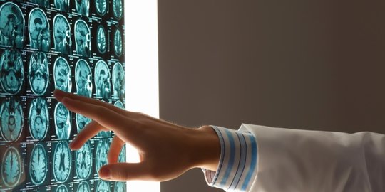 Kenali Faktor Risiko dan Cara Pencegahan dari Penyakit Meningitis