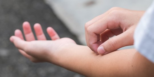 7 hal yang bisa jadi penyebab munculnya rasa gatal tanpa bintik merah