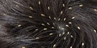 6 Hal yang Bisa Jadi Penanda Adanya Kutu Rambut di Kepalamu