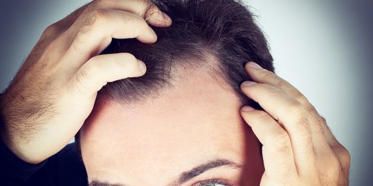 6 hal yang bisa jadi penanda adanya kutu rambut di kepalamu