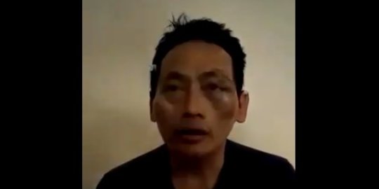 Polisi Pastikan Kasus Penganiayaan Ninoy Karundeng Bukanlah Rekayasa