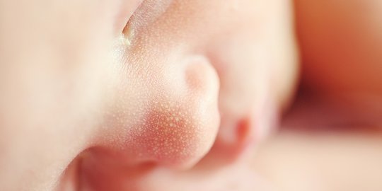 Bayi Asal Madina yang Lahir Kondisi Mengenaskan Meninggal Dunia