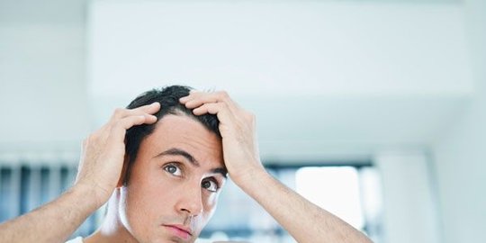 4 cara mencegah kerontokkan rambut pada pria secara efektif
