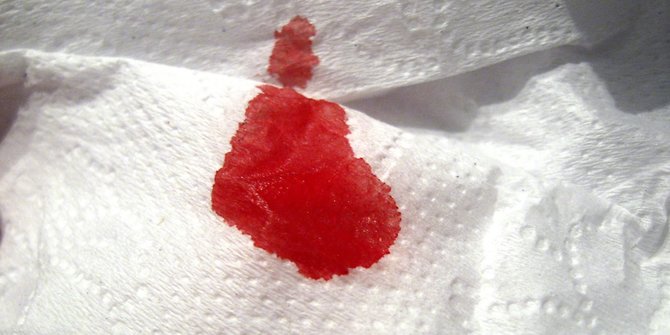 7 Kondisi Darah Menstruasi yang Penting untuk Kamu Ketahui