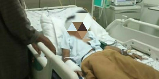 Usai Pedagang, Bocah Usia 8 Tahun di Depok Digigit Ular Kobra