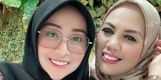 Penampilan Elly Sugigi Usai Potong Gigi: Aku Tetap Elly Sugigi Bukan Elly Surapi