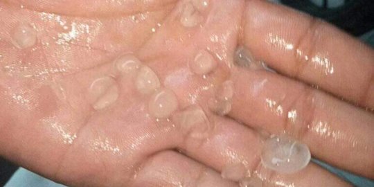 Puting Beliung dan Hujan Es Terjang Baturraden dan Purwokerto