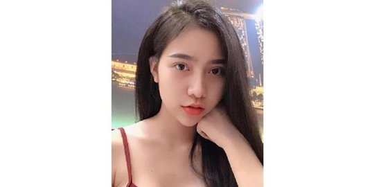 keluarga usai operasi plastik
