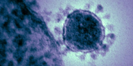 Satu Orang Diduga Terjangkit Virus Corona Dirawat di RSPI Sulianti Saroso Jakut