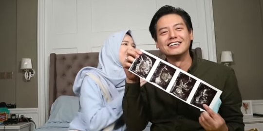 Momen Bahagia Roger Danuarta Saat Cut Meyriska Tunjukan Hasil USG, Sampai Nangis