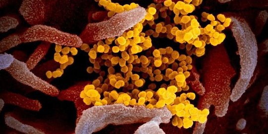 Begini Penampakan Foto Mikroskopis Virus Corona dan Asal Usul Namanya