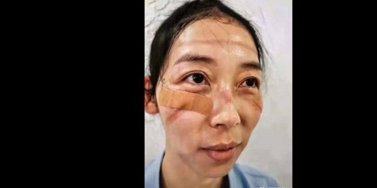 penelitian sebut virus corona baru lebih menular dibanding sars atau mers