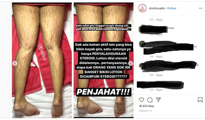 korban krim pemutih ilegal