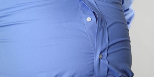 Hindari Obesitas karena Bisa Berujung pada Masalah Hipertensi