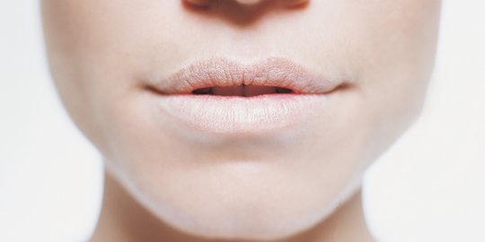 15 Cara Mengatasi Bibir Pecah Pecah Dan Kering Dengan Bahan Alami Merdeka Com