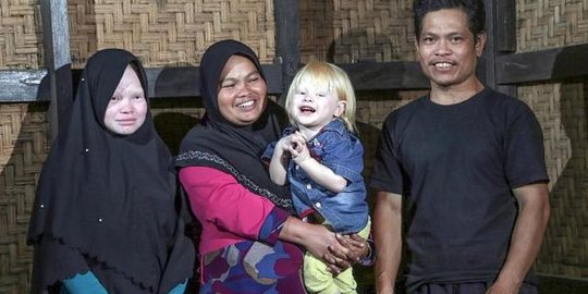 Mengenal Ciburuy, Kampung Albino di Garut yang Sebagian Warganya Mirip Bule