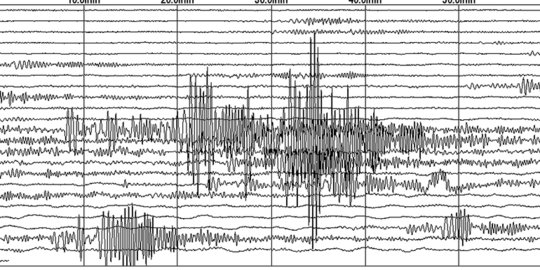 Gempa Magnitudo 5,4 Guncang Sumba Barat NTT