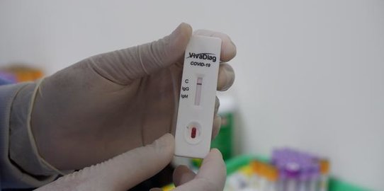 Penjelasan Lengkap Rapid Test Virus Corona & Prosesnya, Bakal Digelar Massal di RI