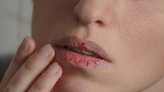 8 penyebab bibir hitam pada wanita
