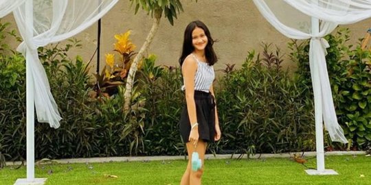 Jarang Tersorot, Ini 5 Potret Anak Ferry Maryadi yang Beranjak Remaja