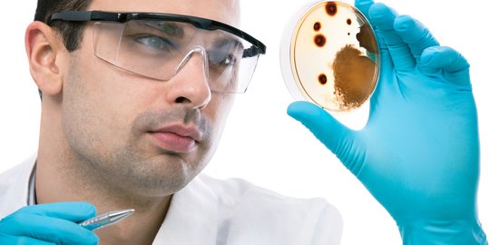 Mengenal 8 Macam Virus Mematikan di Dunia Sebelum Corona