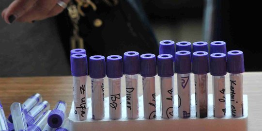 35.083 Warga Jakarta Jalani Rapid Test, 1.027 Dinyatakan Positif