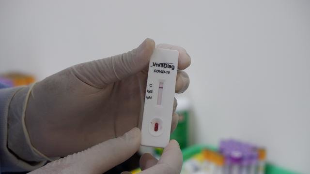 5 fakta bantuan 7000 apd dan 3600 rapid test covid 19 yang diterima sumatera utara