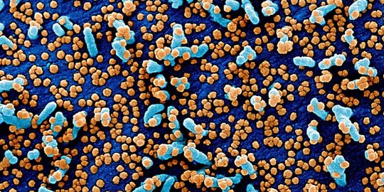 peneliti: virus corona bisa bertahan di suhu tinggi