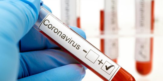 Virus Covid-19 Diprediksi Mulai Masuk Indonesia pada Januari 2020